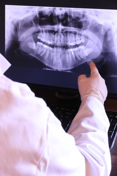 Best Emergency Dental Extractions in Mountain Home, NC
