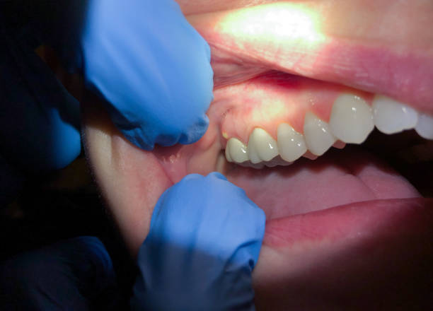Best Broken or Cracked Tooth Emergency Dentist in Mountain Home, NC
