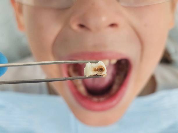 Best Weekend Emergency Dentist in Mountain Home, NC